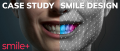 Cas Clinique: Smile Design