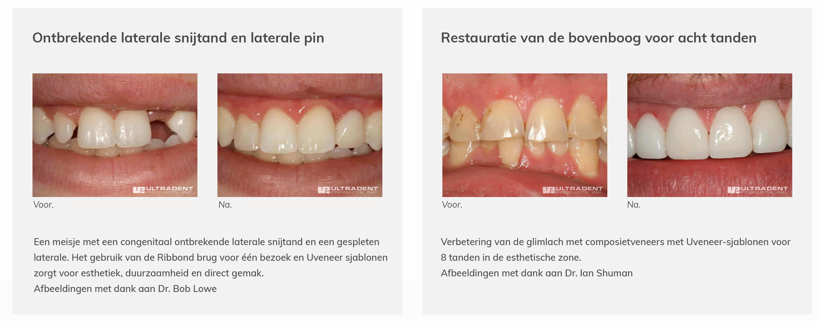 CLINICAL_UVENEER_1_NL.jpg