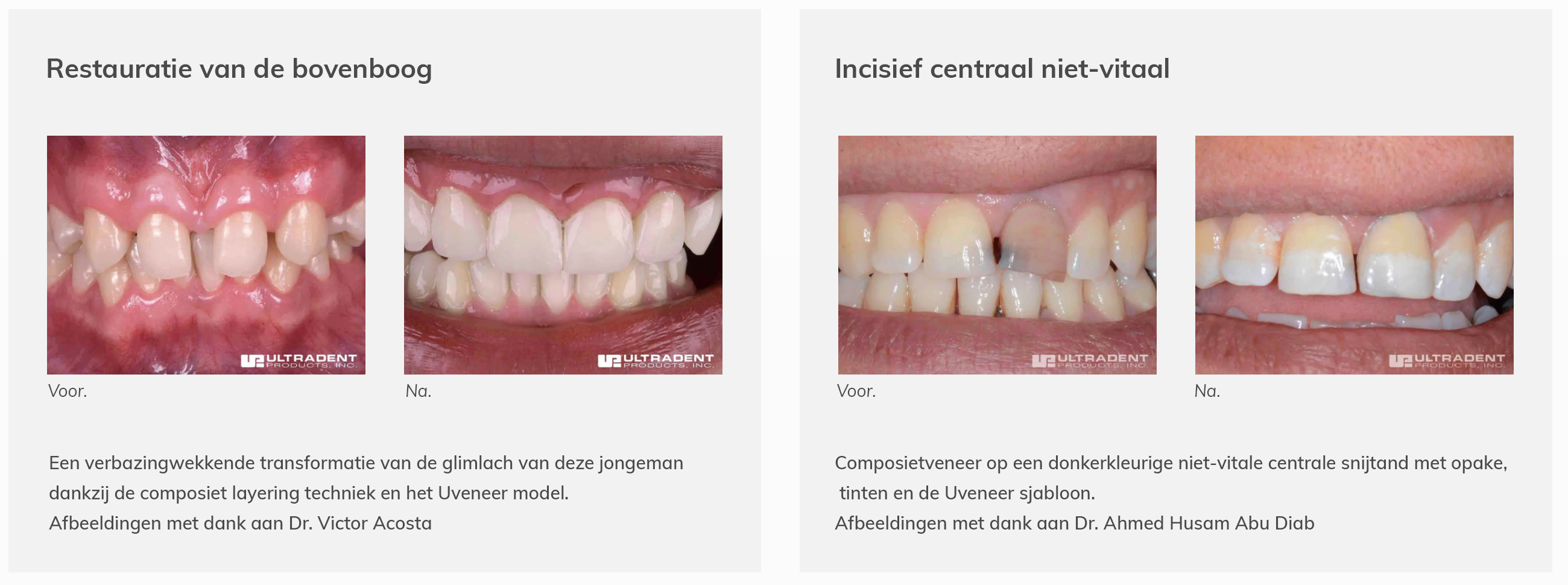 CLINICAL_UVENEER_2_NL.jpg