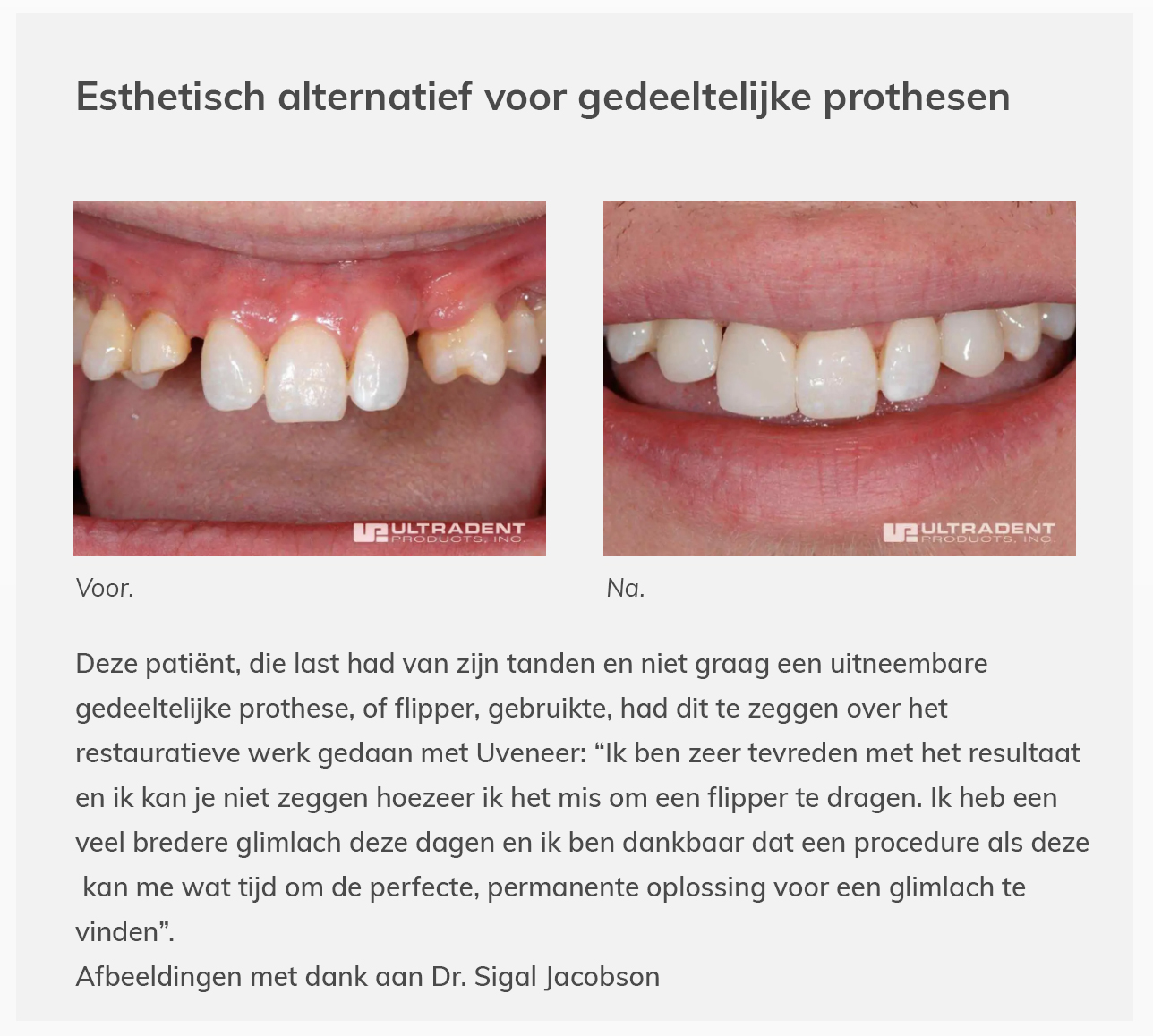 CLINICAL_UVENEER_3_NL.jpg