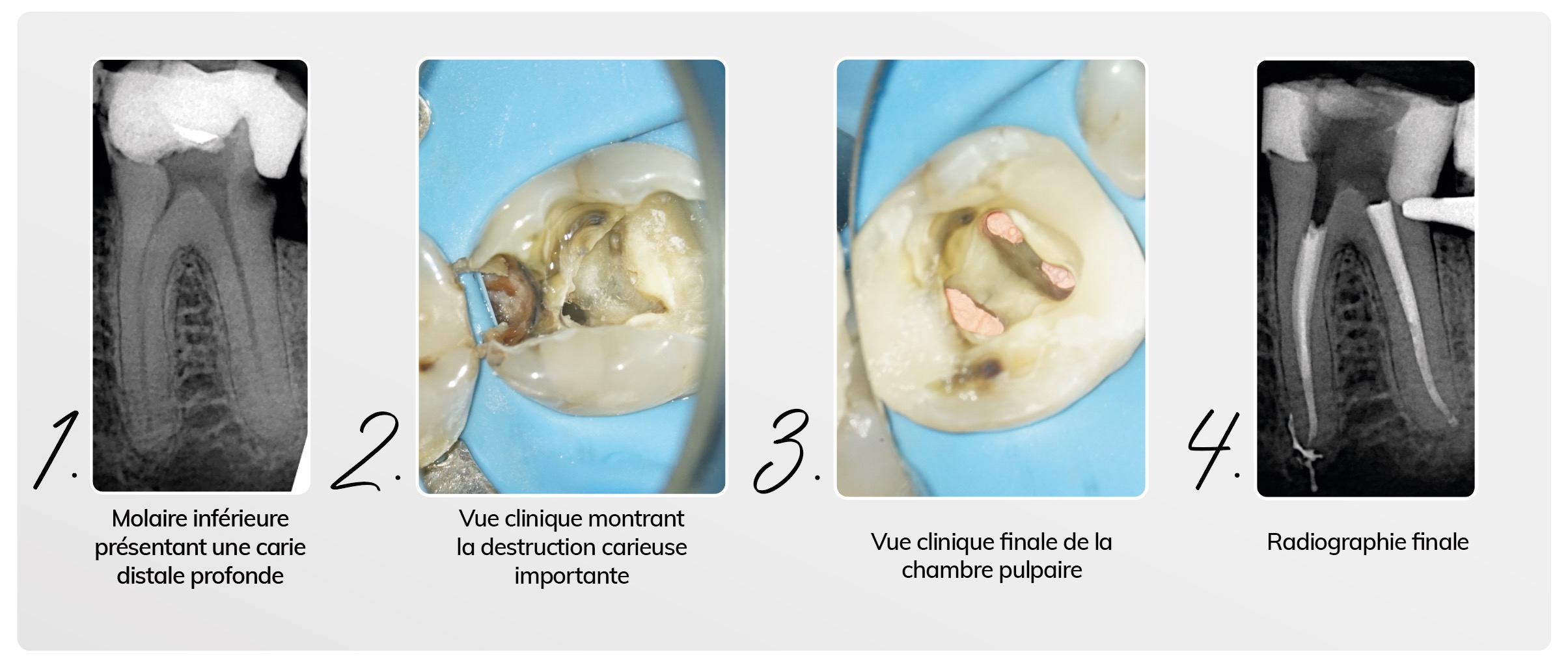 L'évolution clinique